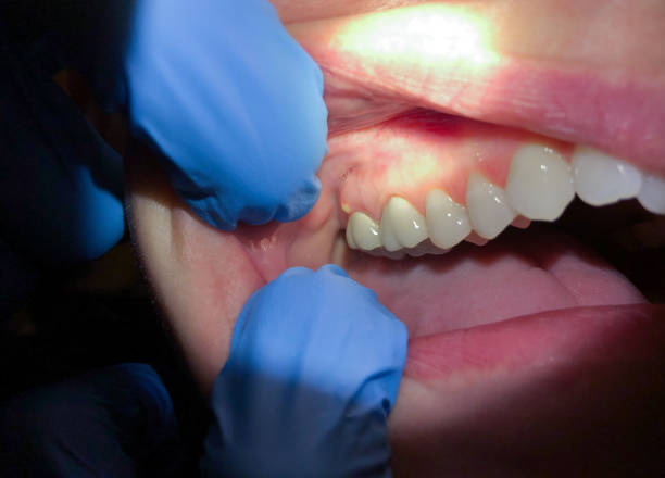 Best Emergency Broken Tooth Repair in Shoshone, ID
